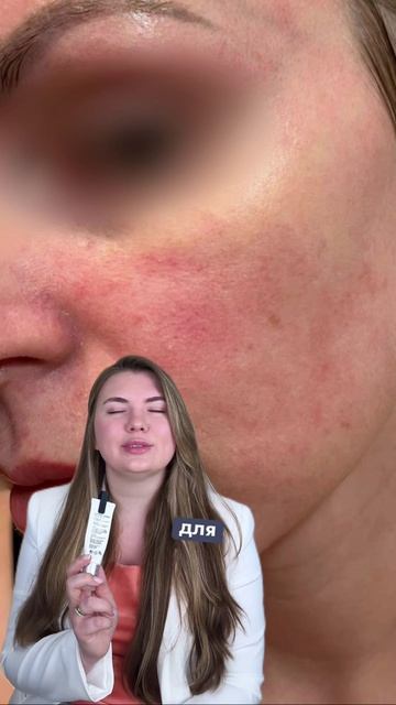 Краснеет лицо