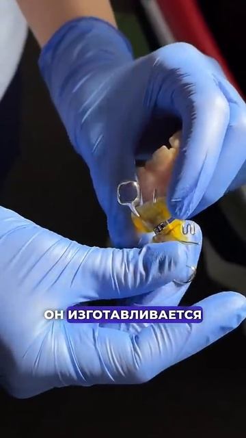 Этот аппарат - спасение для детей! ❤️ Стоматология “СТОЛИЦА”  Москва