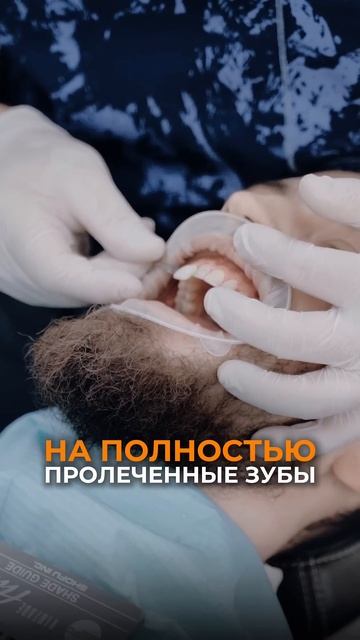 Вам ОТКАЖУТ в винирах, если у вас ЭТА проблема! Срочно к стоматологу!