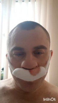 ПроЗдоровье.Операция на верхнечельстной пазухе.Фильм2.Серия5.Часть5 .mp4