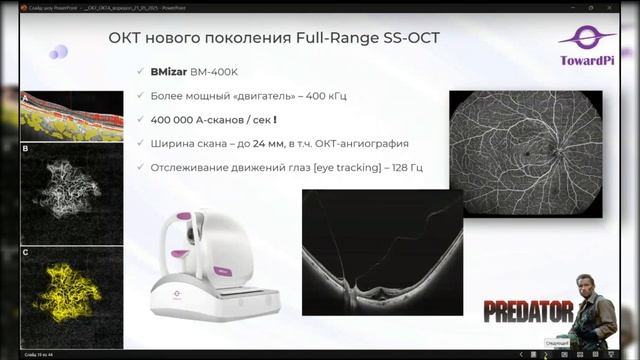 Воркшоп по ОКТ и ОКТ-ангиографии. Обзор оптического когерентного томографа BMizer TowardPI