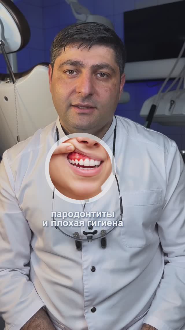 Сколько служат керамические виниры?