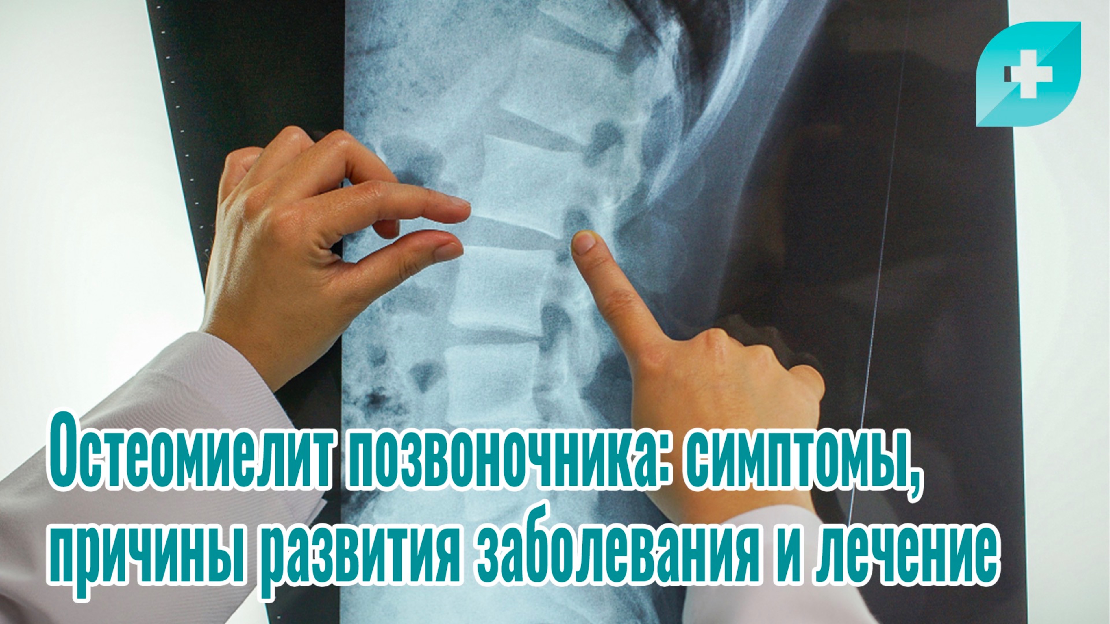 Остеомиелит позвоночника: симптомы, причины развития заболевания и лечение