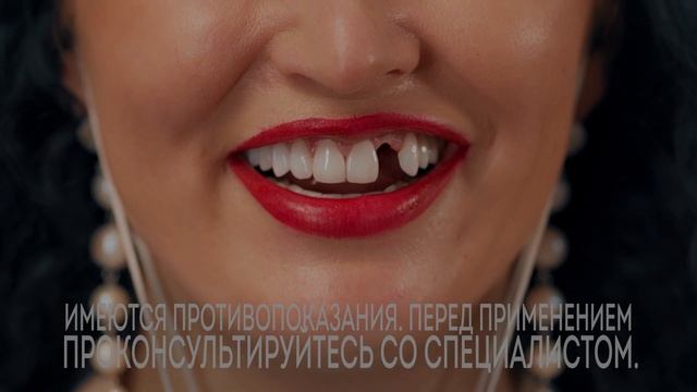 Имплантация зубов за один день!