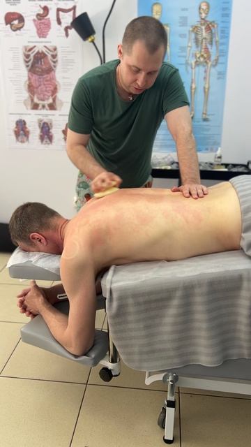 Динамический баночный массаж.