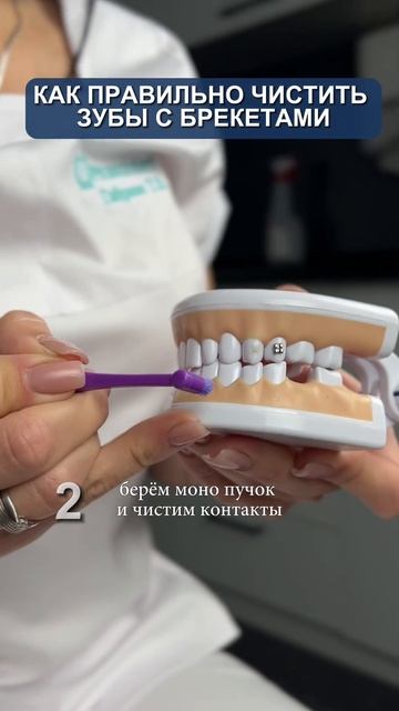 Чистка брекетов за 2 минуты? Да, если знаешь секрет!