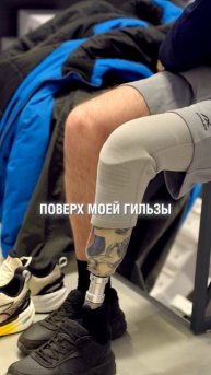 Дизайн протеза