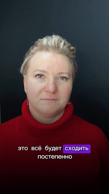 Пластика нижних век - результат через месяц после операции