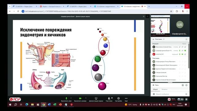 Доклад_15_3_Органосохраняющие методы лечения пациенток с миомой матки и аномалией развития мочевой с