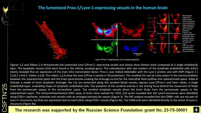 3D visualization of the brain's lymphatic system