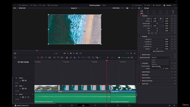 32 - Dynamic Zoom in Edit Page
