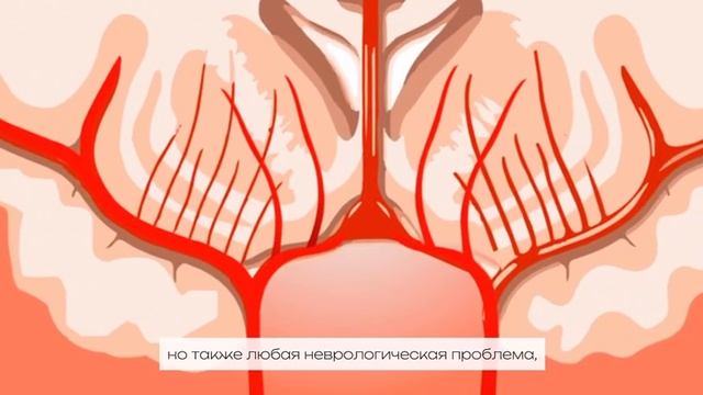 Отделение неотложной неврологии