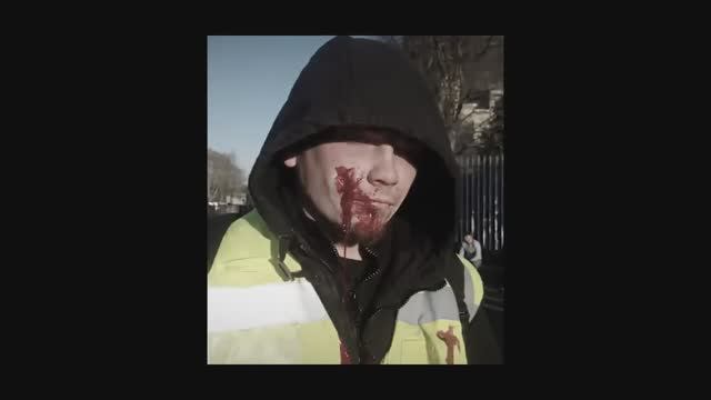 у потомков ЕВРОПЕЙЦА гитлера ТЕЖЕ цИнИстИ что и у самого ЕВРОПЕЙЦА гитлера