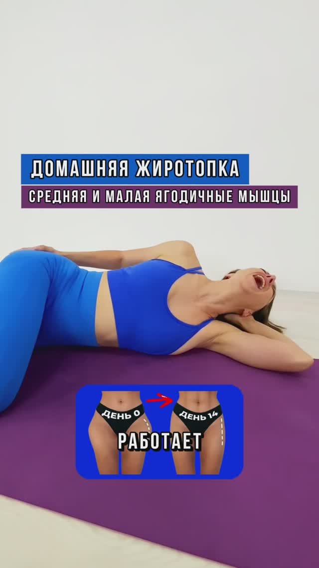 Ушки на бёдрах портят фигуру? Жиротопка на малую и среднюю ягодичную мышцы