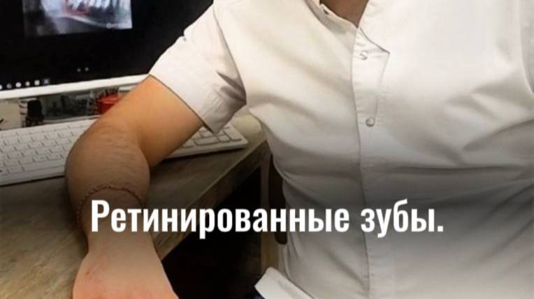 Ретинированные зубы