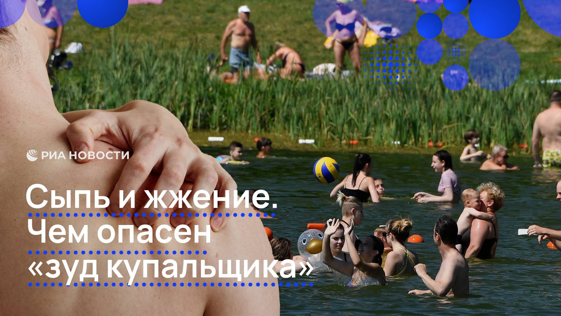 Сыпь и жжение. Чем опасен "зуд купальщика"