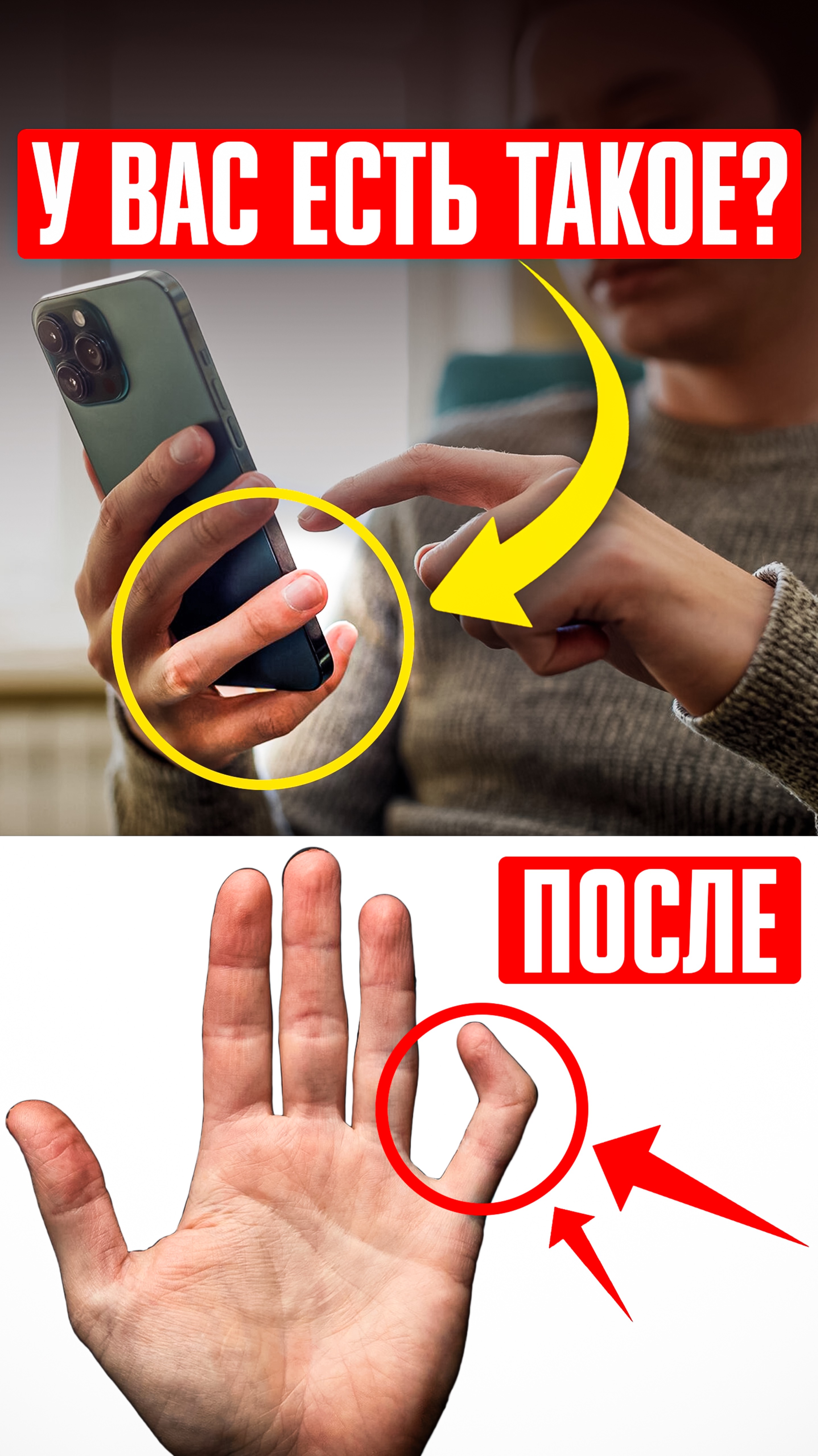 💀 Главная БОЛЕЗНЬ XXI ВЕКА: СИНДРОМ СМАРТФОННОГО ПАЛЬЦА