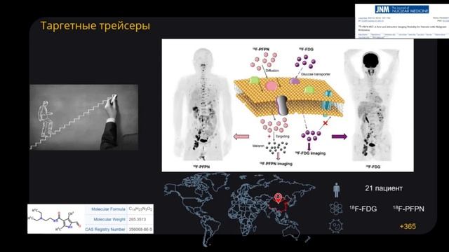 ПЭТ/КТ диагностика злокачественных новообразований: опухоли кожи, мягкотканные опухоли.