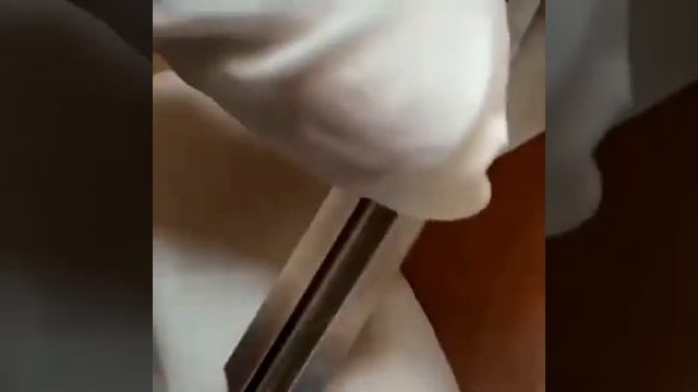 Самое залипательное видео давить прыщи. Черные точки.