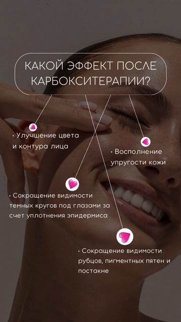 Сторис Карбокситерапия / content-russia.tb.ru