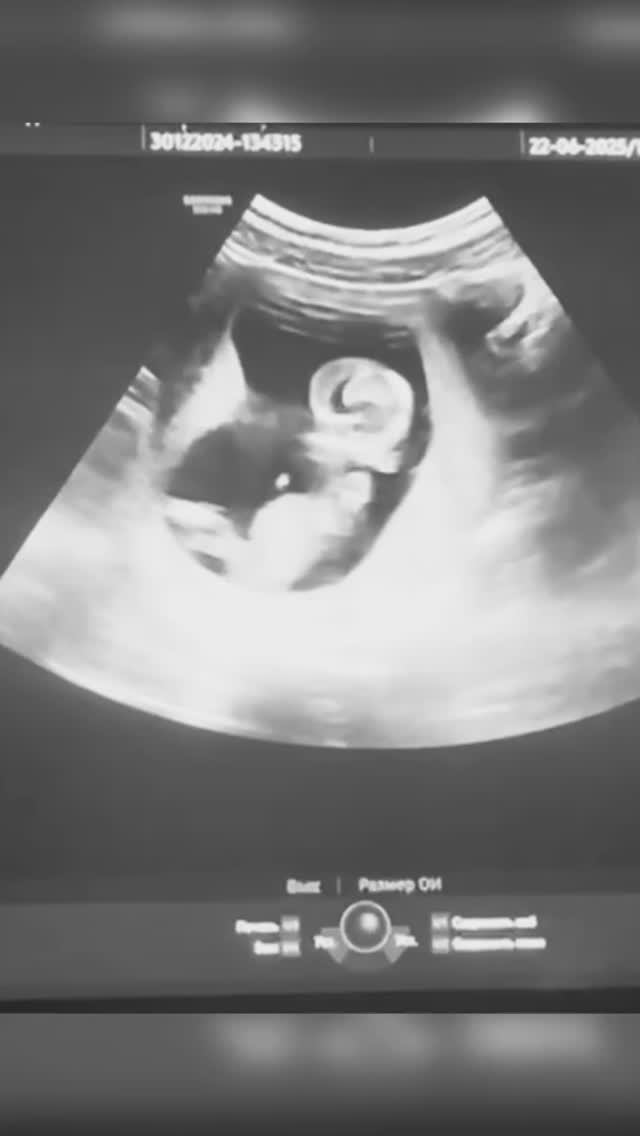 МОЯ БЕРЕМЕННОСТЬ _ ФИНАЛ 🤰