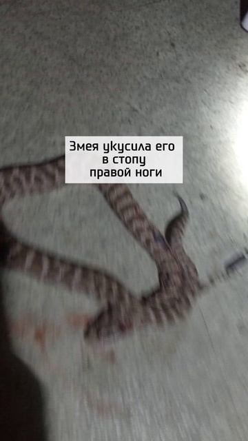 Мужчину спасли после укуса ядовитой змеи