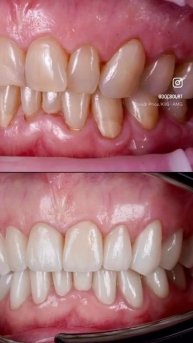 БЛИСТАТЕЛЬНАЯ УЛЫБКА