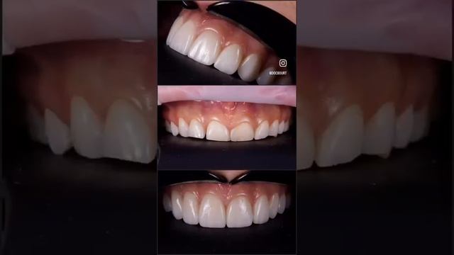 Как приятно делать людей не только здоровыми, но еще и красивыми!!!