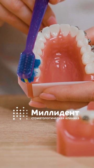 Как чистить зубы в брекетах? #брекеты #чистказубов