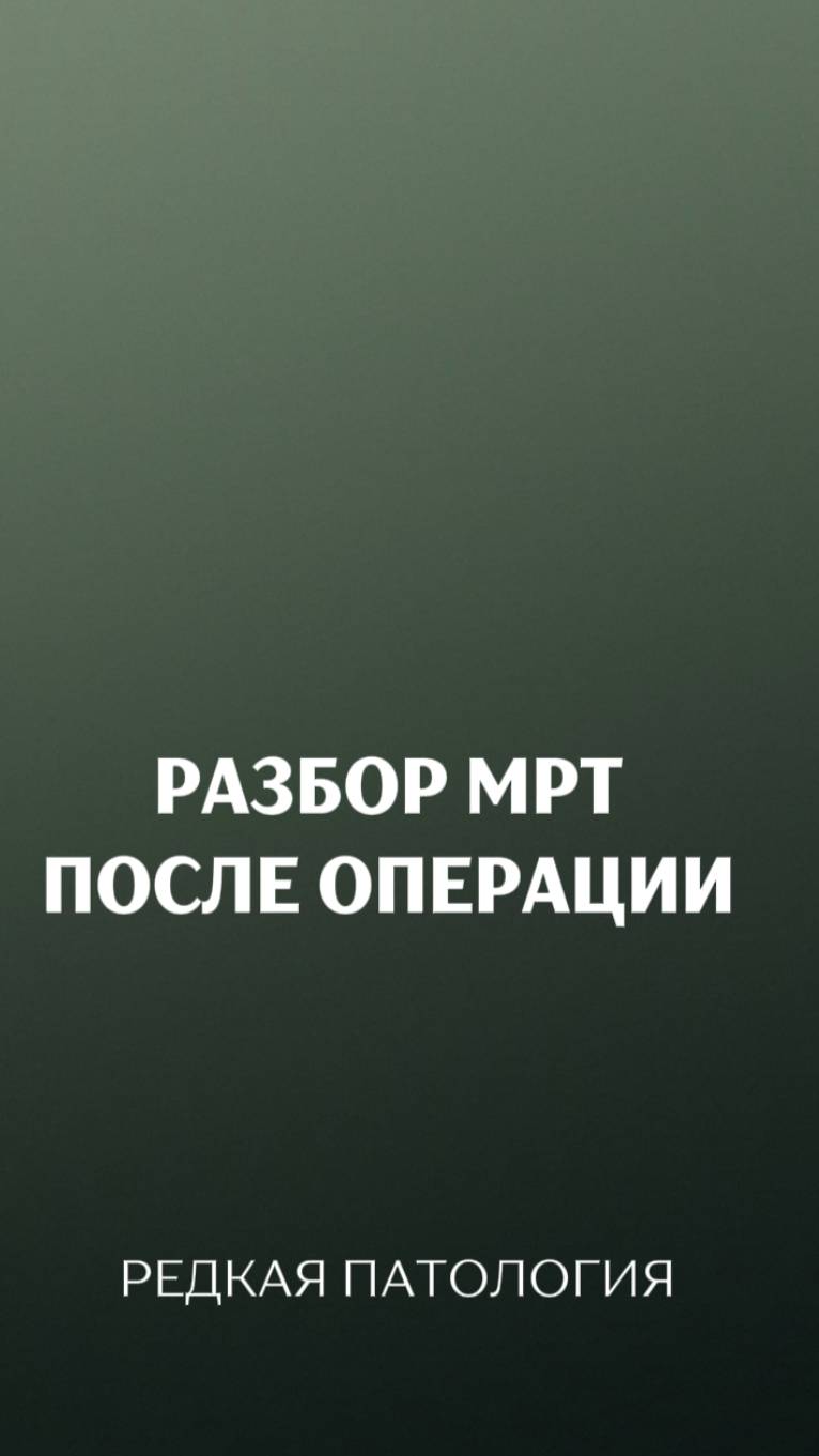 Разбор МРТ после операции