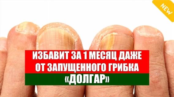 🚫 Грибок на ногах луиза хей ⚡ От грибка ног 🤘