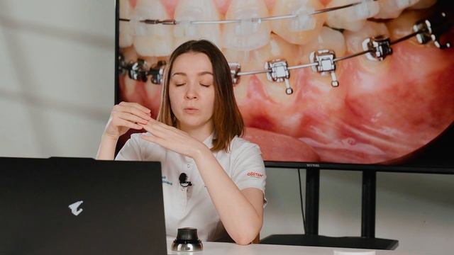 5 советов, которые ускорят ЛЕЧЕНИЕ НА БРЕКЕТАХ – отвечает стоматолог профессионал