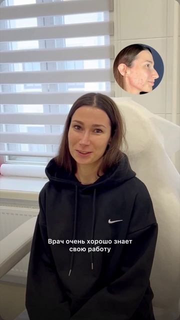 Отзыв после ринопластики у доктора Карповича