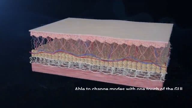Ultraformer MPT в центре косметологии Yourwings
