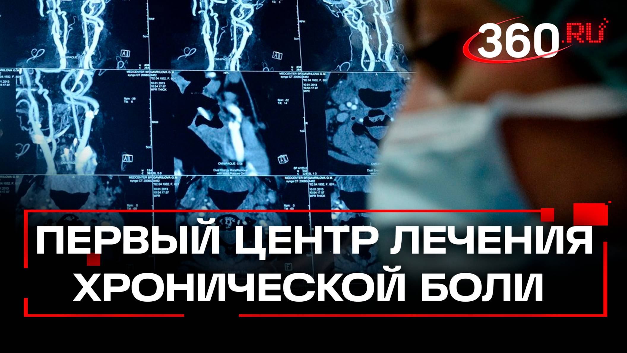 В Красногорске открылось первое в Подмосковье отделение лечения хронической боли