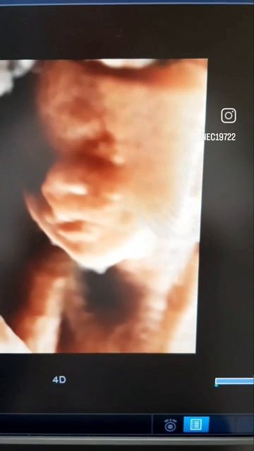 VID_20250619_043815_595.mp4