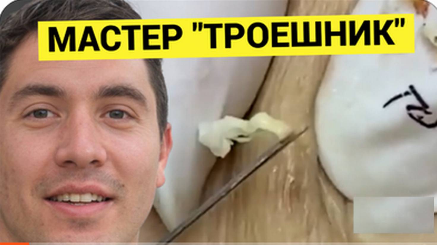 БЕЗДАРНЫЙ _Троешник_ На Чистке Лица от Черных Точек