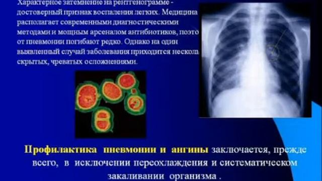 Профилактика внебольничной пневмонии