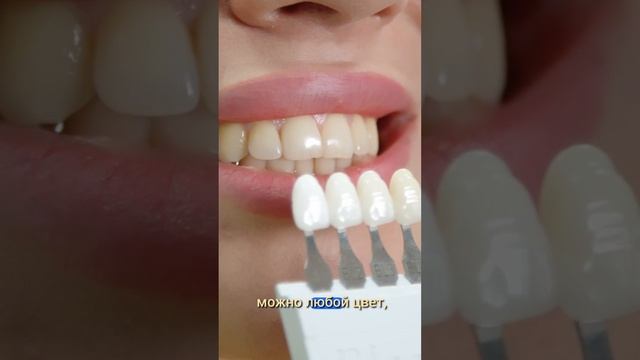 Отбеливание зубов — самая бесполезная процедура? #стоматология, #отбеливаниезубов, #виниры