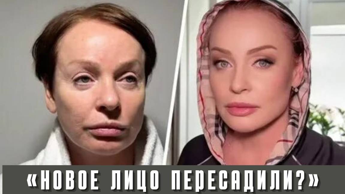 Вот как Выглядит 60-летняя Жанна Эппле после Пластики