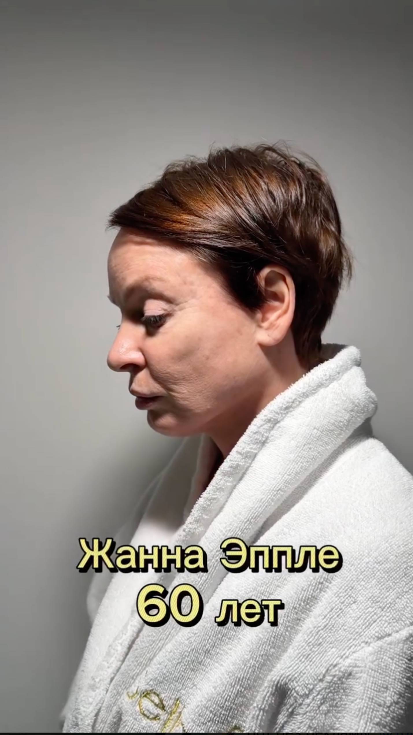 Жанна Эппле до/после невидимой подтяжки лица!  #сергейсвиридов