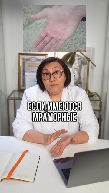 Твоя ладонь знает больше, чем ты думаешь. Вот на что обратить внимание по утрам.