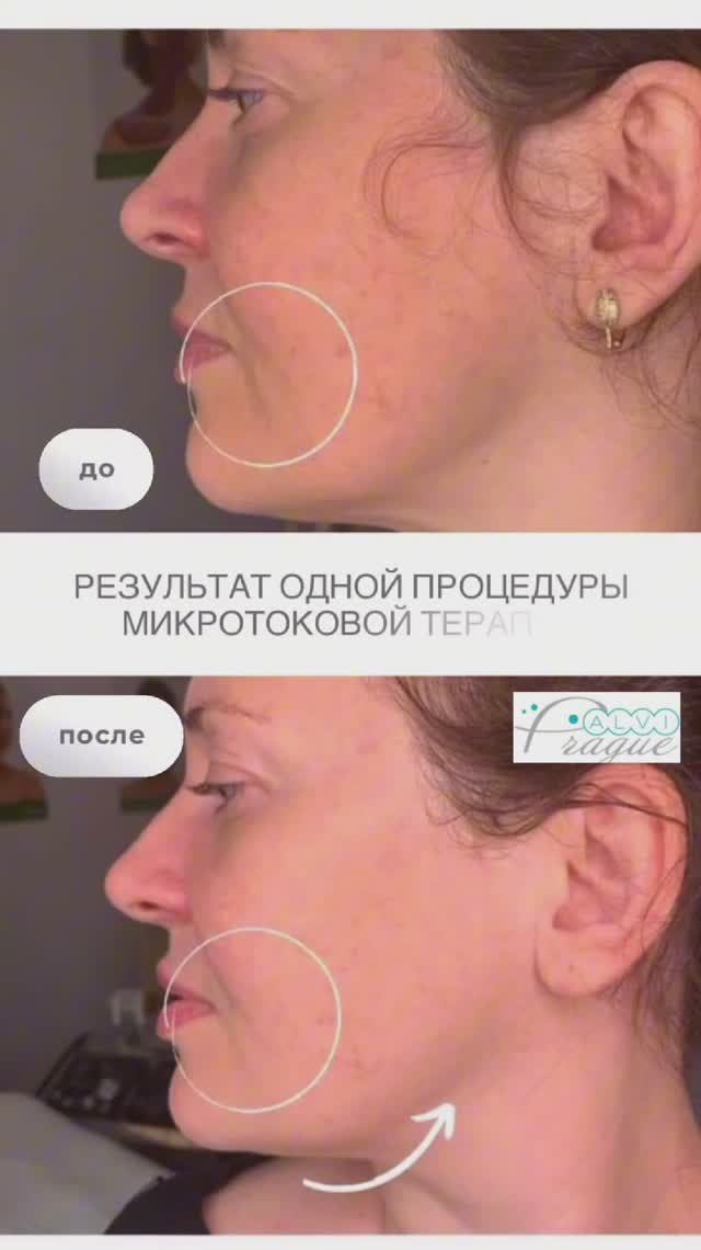 Профессиональный аппарат для микротоковой терапии T-15