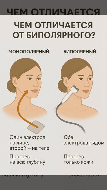 Монополярный РФ-лифтинг: факты, которые обязан знать каждый косметолог