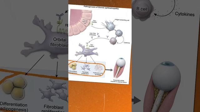 Выпучить глаза  не от страха, а из-за щитовидной железы