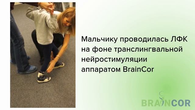 Результаты реабилитации с BrainCor после инсульта в 4 года.