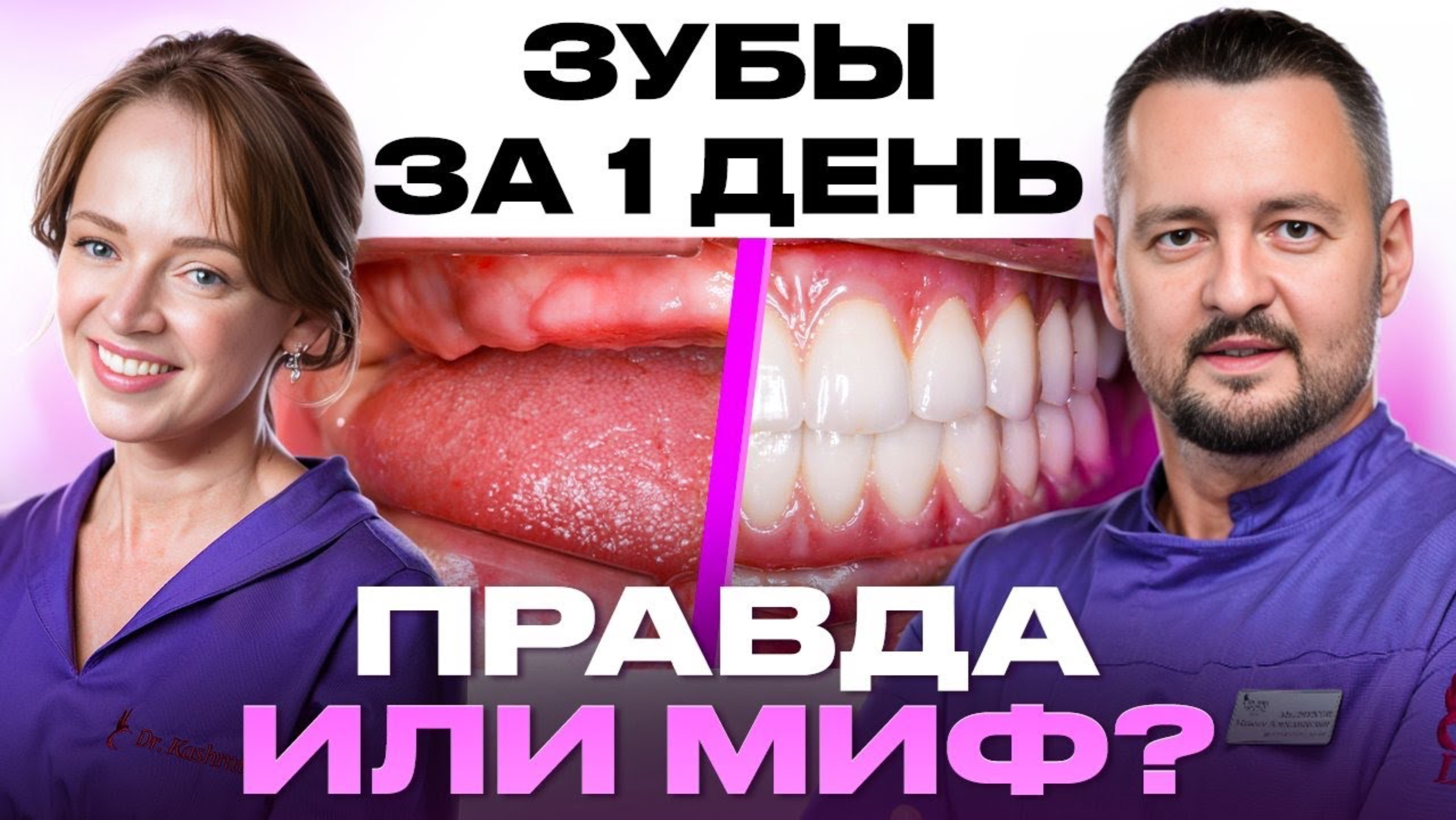 ЧТО БУДЕТ, ЕСЛИ ВОССТАНОВИТЬ ЗУБЫ ЗА 1 ДЕНЬ? МЕТОДИКА ОДНОМОМЕНТНОЙ ИМПЛАНТАЦИИ