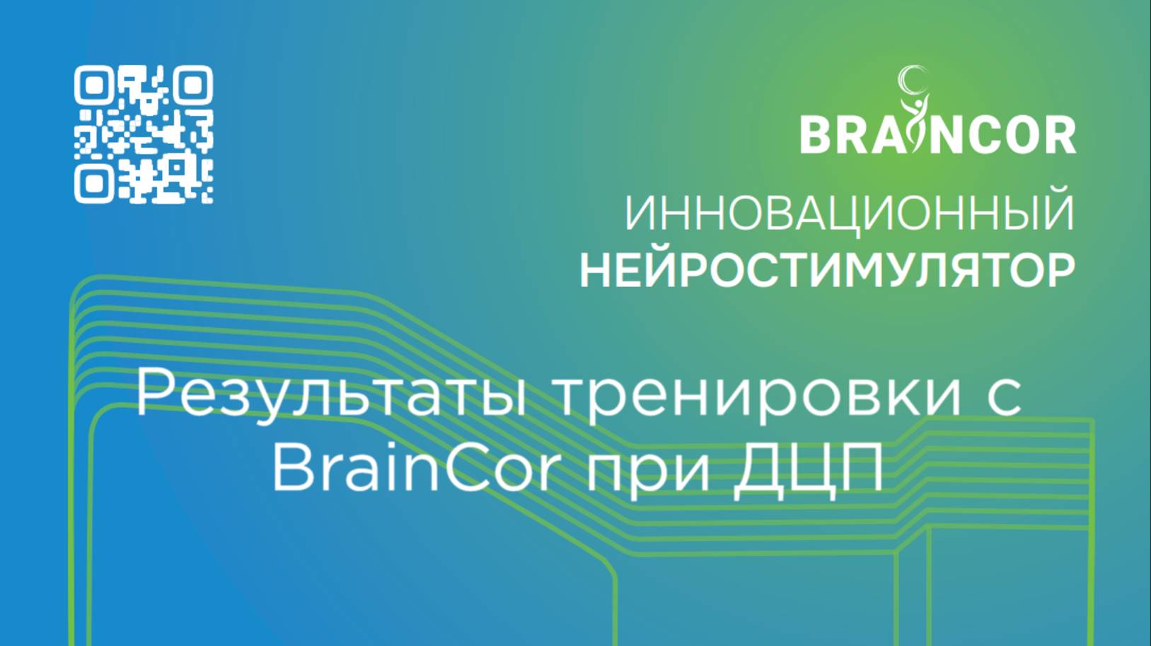 Результат тренировки с нейростимулятором BrainCor при ДЦП