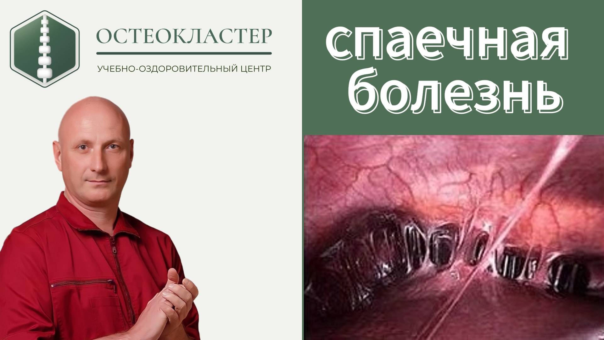 Спаечная болезнь.