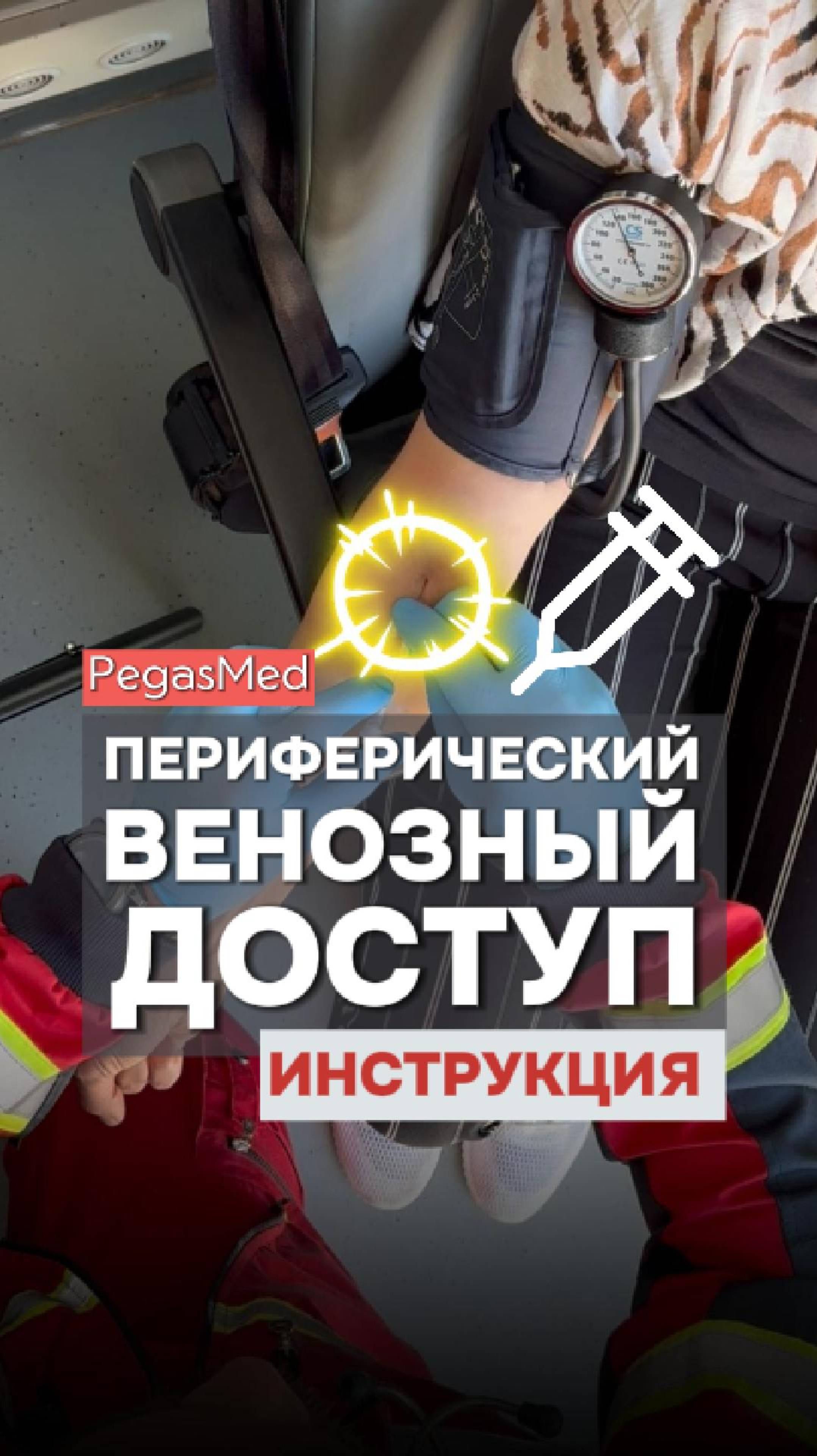 🔍💉Катетеризация периферических вен: техника поиска и пунктирования